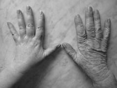 Our hands